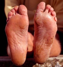 L'objet des soins permanents des pèlerins (cl. PMA) L'objet des soins permanents des pèlerins (cl. PMA)